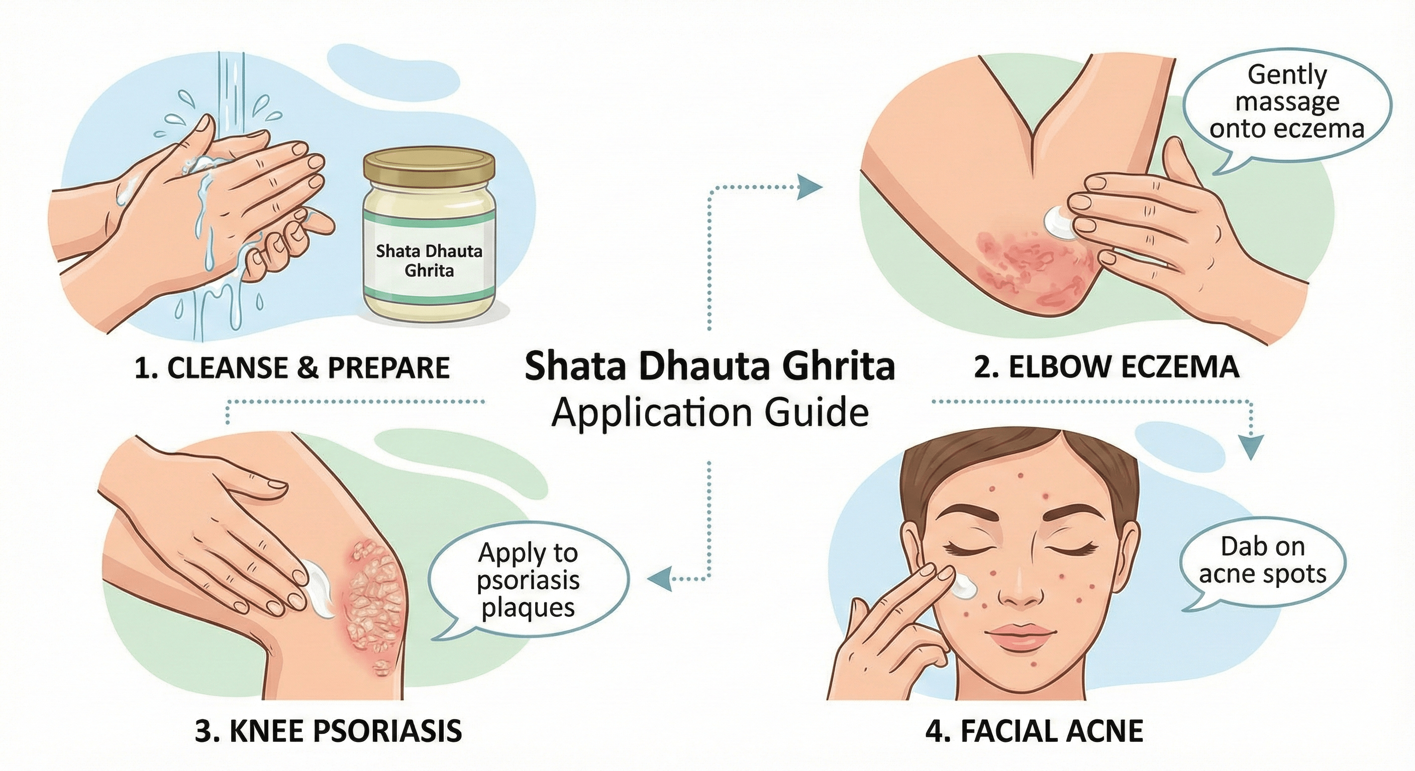 Application technique for psoriasis and eczema treatment with Shata Dhauta Ghrita showing proper method